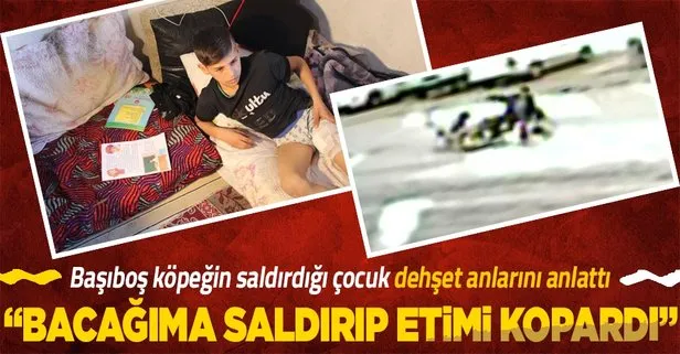 Ankara’da başıboş köpeklerin saldırdığı Ramazan Aslan: “Arkamı döndüm köpekler bacağıma saldırıp etimi kopardı”