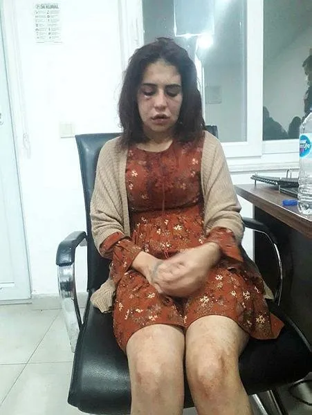 Son dakika: Antalya Alanya'da yürek yakan 'ölmek istemiyorum' çığlığı! Beyza Yurttaş öldüresiye dövüldü-7