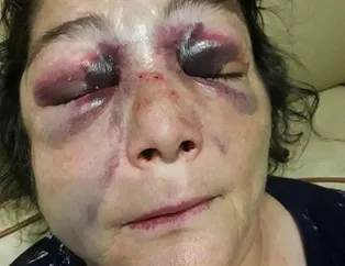 Tezel: CHP’liler dövünce kadına şiddet olmuyor mu?