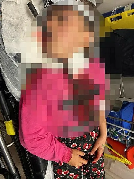 adanada-insaatta-dusen-kucuk-kizin-bogazina-demir-cubuk-saplandi-agzindan-cikti-1641826550103.jpeg Adana'da inşaatta düşen küçük kızın boğazına demir çubuk saplandı! Ağzından çıktı...-1