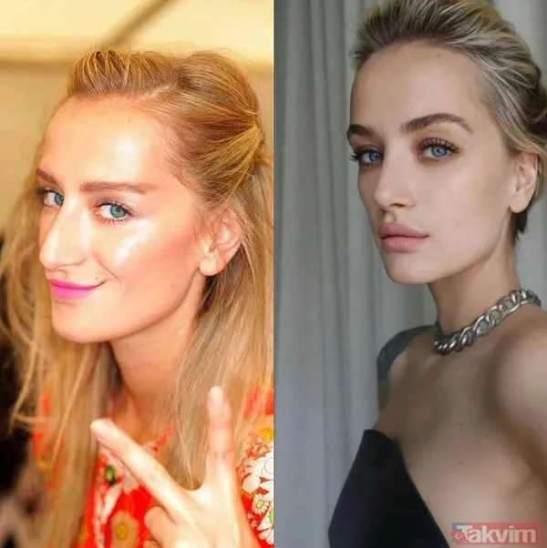 Esra Bilgiç estetik harikası çıktı! Eski halini görenin gözleri fal taşı gibi açıldı: Doğal sanıyordum! Diriliş Ertuğrul’un yıldızı... - 17