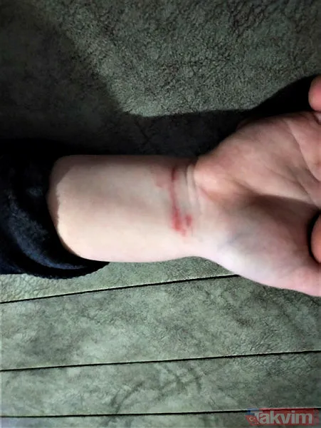 Antalya'da bir babanın iddiaları duyanları şoke etti! Parmaklarında yanık izleri, bileklerinde morluk... - 5