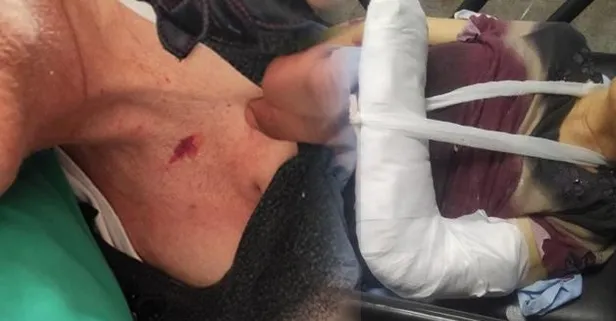 Özel hastanede kan donduran şiddet iddiası! 72 yaşındaki kadının sağlık durumu ciddiyetini koruyor