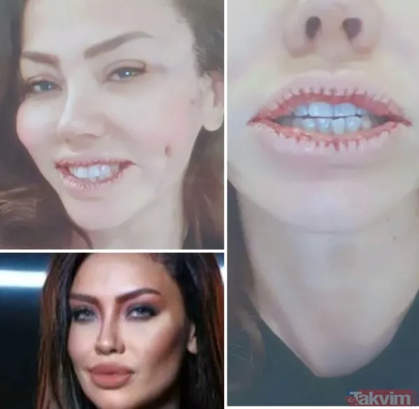 Şarkıcı Lara sonunda küçülttü! Estetikle bambaşka biri olan Lara paylaştı görenler 'yok artık' dedi - 3