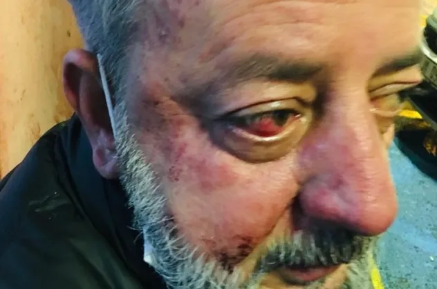 Üsküdar'da yaşlı adamı kiracıları dövdü