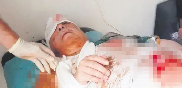 Terörist Mihraç Ural, bombalı saldırı ağır yaralandı-1