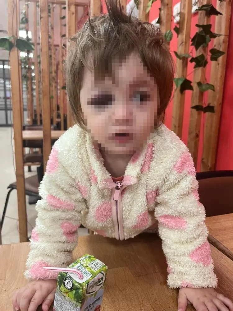 yalovada-magandalardan-kucaginda-bebek-olan-babaya-hain-saldiri-1771785458486.jpeg Yalova'da kucağında çocuk olan babaya hain saldırı! 14 aylık bebeğin kafatası kırıldı-4