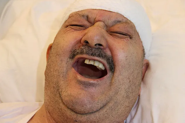 Diş ağrısı sandı sağlam 6 dişini çektirdi! Gerçek bambaşka çıktı! Delirten hastalık...