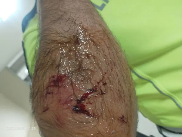 alkollu-surucu-ehliyetini-isteyen-polis-memuruna-yasakli-kopek-irki-dogo-argentino-ile-saldirtti-kolunu-isirtt-1661951371901.jpg Alkollü sürücü ehliyetini isteyen polis memuruna yasaklı köpek ırkı 'Dogo Argentino' ile saldırttı! Kolunu ısırttırdı-3