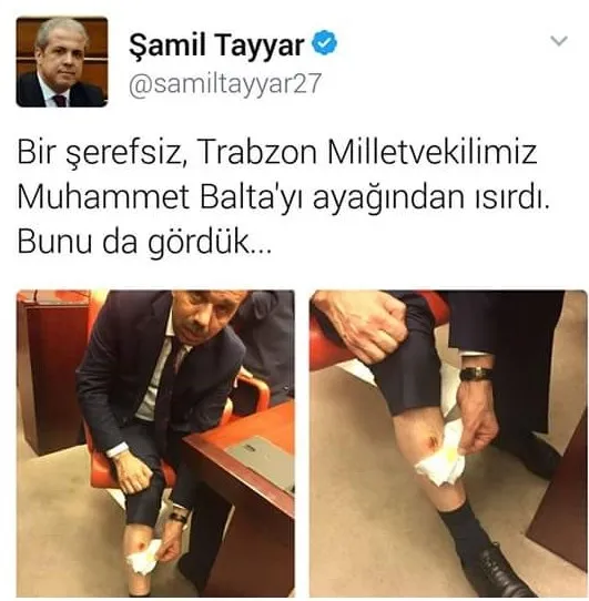 CHP'li vekil AK Partili Balta'nın bacağını ısırdı-4