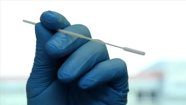 son-dakika-saglik-bakanligi-81-ile-yazi-gonderdi-koronavirus-test-ucreti-250-tl-1606110509789.jpg SON DAKİKA: Sağlık Bakanlığı 81 ile yazı gönderdi: Koronavirüs test ücreti 250 TL-8