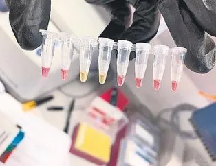 30 dakikada tanı imkanı
