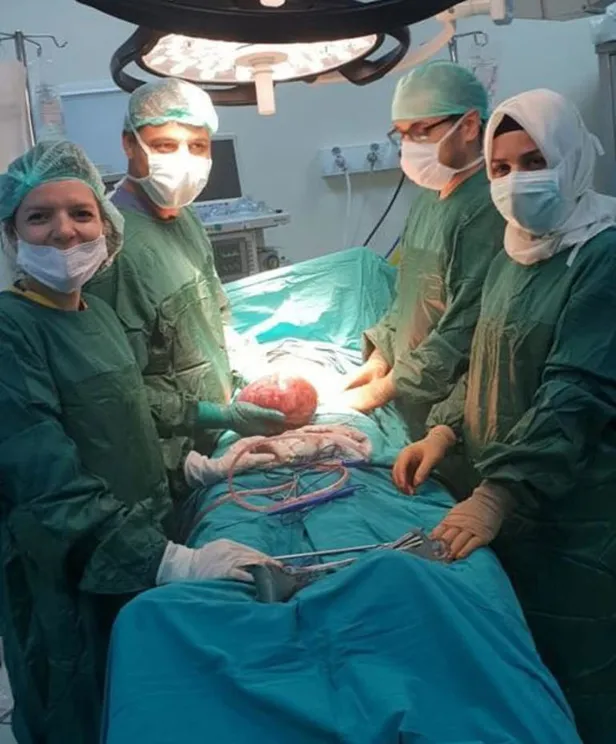 Hastanın karnından 3 kiloluk kist çıktı-1