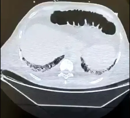 Koronavirüs işte böyle yayılıyor! Bunu daha önce hiç görmediniz!-5