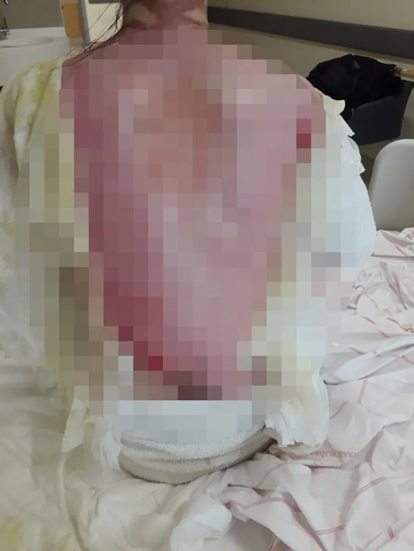 esinin-sicak-su-dokerek-hasladigi-rukiye-ayin-yurek-yakan-sozleri-bana-abla-diyor-1611992012195.jpg Eşinin sıcak su dökerek haşladığı Rukiye Ay'ın yürek yakan sözleri: Bana abla diyor-9