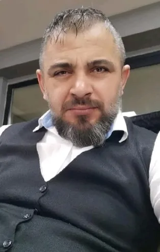 Lüks otelde kaldı hayatı kabusa döndü! Böbreğini kaybetti