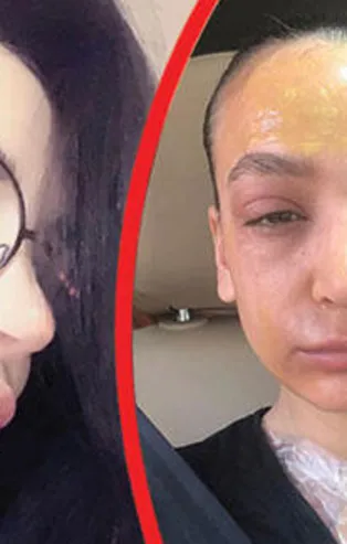 Lavabo açıcı kullanan kadın dehşeti yaşadı! Ünlü firmaya 1.5 milyon liralık tazminat