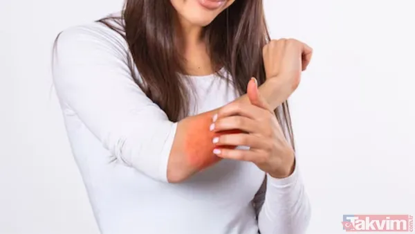 Doğal Koruma İçin Lavanta Yağı Yeter Market Raflarında Bulunan Sinek Kovucu Spreyler Çoğunlukla Kimyasal İçerikli Olması Nedeniyle Özellikle Hassas Cilde Sahip...