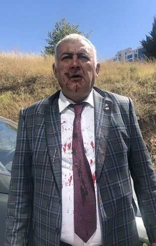 İşte Zafer Partisindeki kavganın görüntüleri! Ümit Özdağ tayfasının FETÖ'cülükle suçladığı Soner Çam ve arkadaşına saldırı anı! Takvim.com.tr ulaştı