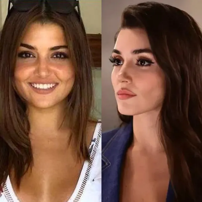 Yüz lifting yaptıran Ebru Yaşar’ın son hali olay oldu: İnsan bunu kendine nasıl yapar? - 15