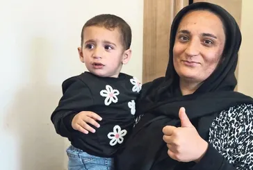 İşitme engelli ailenin bebeğine biyonik kulak ameliyatı: İlk kez sesleri duydu