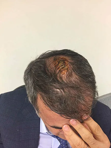 Şenol Güneş'in kafasına ne atıldı? İşte o rapor...-4