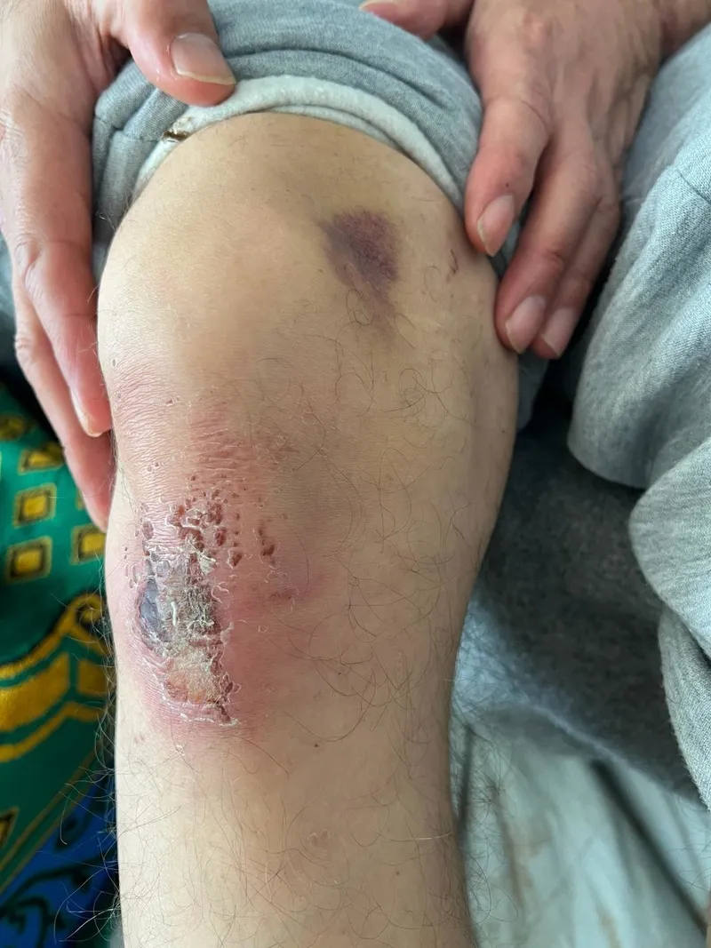 soykirimci-israil-vahsete-doymuyor-el-emel-hastanesinde-alikoydugu-2-doktora-uyguladigi-iskencenin-fotograflar-1708186233336.jpeg Soykırımcı İsrail vahşete doymuyor! El-Emel Hastanesinde alıkoyduğu 2 doktora uyguladığı işkencenin fotoğrafları ortaya çıktı-2