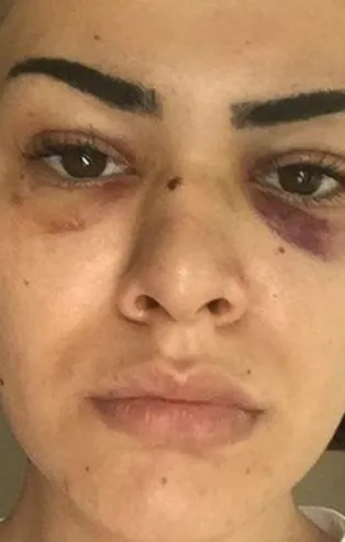 İstanbul'da taciz dehşeti! Genç kadın yaşadığı korku dolu anları anlattı: Kan kusmaya başladım