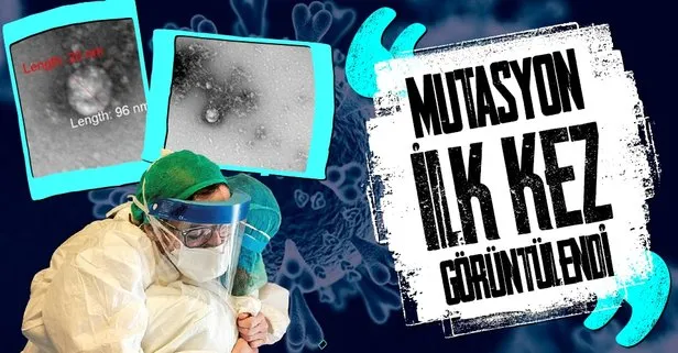 Rus bilim insanlarından şoke eden koronavirüs araştırması! Yeni mutasyon ilk kez böyle görüntülendi!
