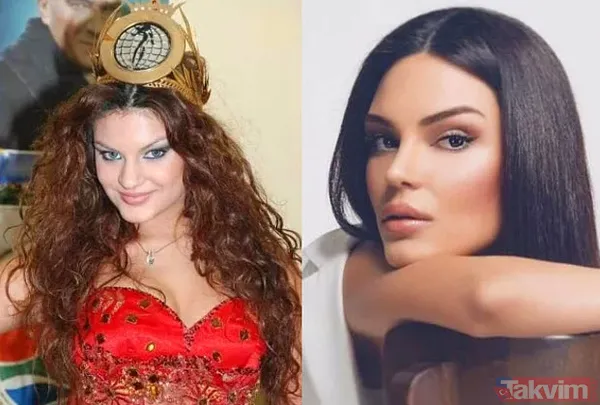 Şarkıcı Lara sonunda küçülttü! Estetikle bambaşka biri olan Lara paylaştı görenler 'yok artık' dedi - 38