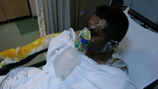 1605774741525.jpg Ailesini kurtardı kendisi yandı! Samsun'da inanılmaz fedakarlık-3