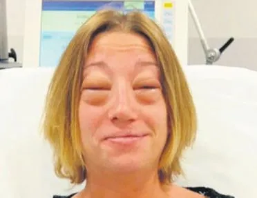 Eşek sütü öldürebilir