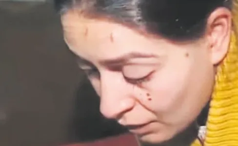 Yüzünü kezzapla yakacağım-1