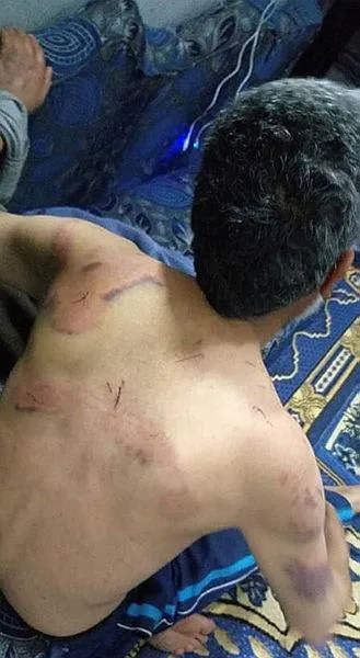 Terör örgütü YPG/PKK'dan insanlık dışı işkence! Böbreğinin biri çalışamaz hale geldi