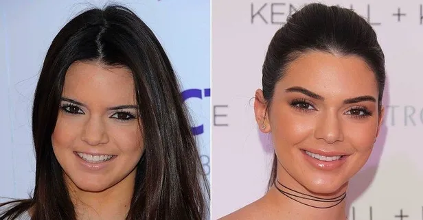 Kendall Jenner, Hadise, Demet Özdemir... Sosyal medya estetik trendine yön verdi