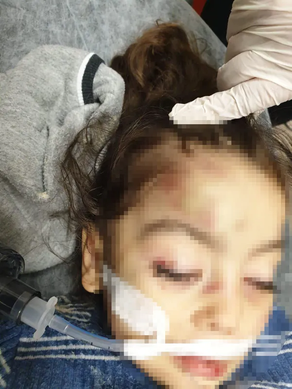 Adana'da isyan ettiren olay! 'Üzerine motosiklet düştü' denilmişti, gerçek ortaya çıktı-5