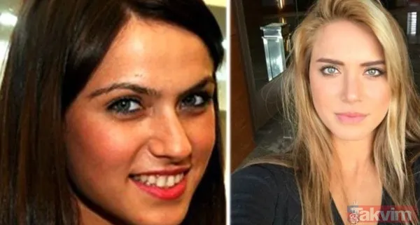 Esra Bilgiç estetik harikası çıktı! Eski halini görenin gözleri fal taşı gibi açıldı: Doğal sanıyordum! Diriliş Ertuğrul’un yıldızı... - 6