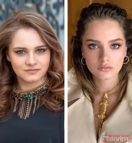 Aleyna Tilki hastanelik oldu paylaşımıyla korkuttu! Sette yürüyemez hale gelen Aleyna Tilki'ye ne oldu? - 25