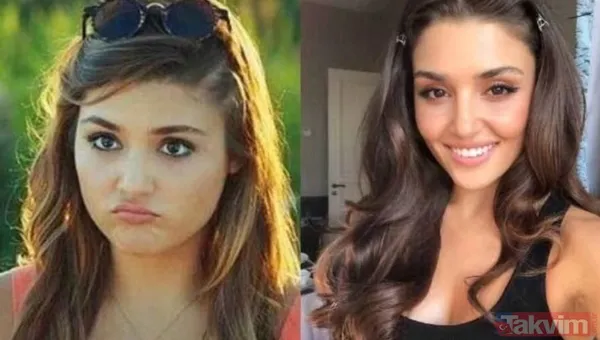 Esra Bilgiç estetik harikası çıktı! Eski halini görenin gözleri fal taşı gibi açıldı: Doğal sanıyordum! Diriliş Ertuğrul’un yıldızı... - 25