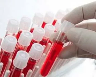 Kan testiyle kanser teşhisi