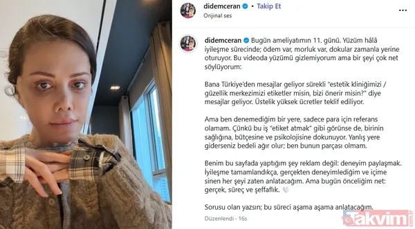 Eski Survivor yarışmacısı Didem Ceran Güney Kore'de 15 saatlik "yüz nakli" operasyonu geçirdi - 5