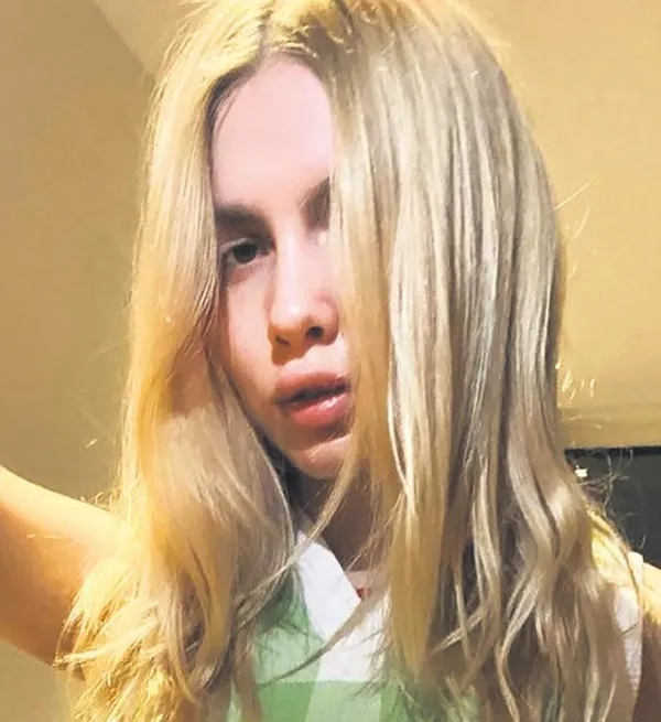 Estetik faciası mı oldu? Londra'da canı sıkılan Aleyna Tilki, sosyal medyada takipçileriyle buluştu-4