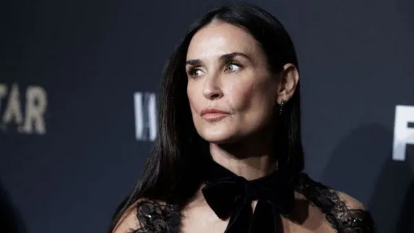 Demi Moore,Victoria Beckham, Almeda Abazi... Ünlüler, şimdi de sülük tedavisi için sıraya girdi:-2