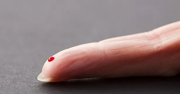 Rüyada kan görmek ne anlama gelir? Rüyada kan görmenin tabiri...