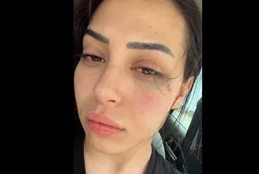 Darp edilen Türk kız hakkında skandal iddia