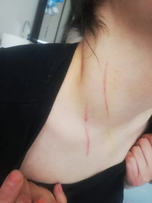 Rezidansta işkence gören Demet A'nın bilirkişi raporu ortaya çıktı! Sigara yanığı, boyun çevresinde ve yüzünde bıçak çizikleri...-9