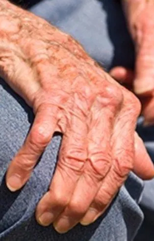 Romatizmaya portakal mucizesi!