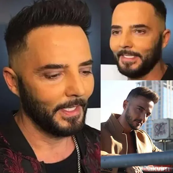 Alişan'dan botoks itirafı! İşte estetik yaptıran erkek ünlüler - 9