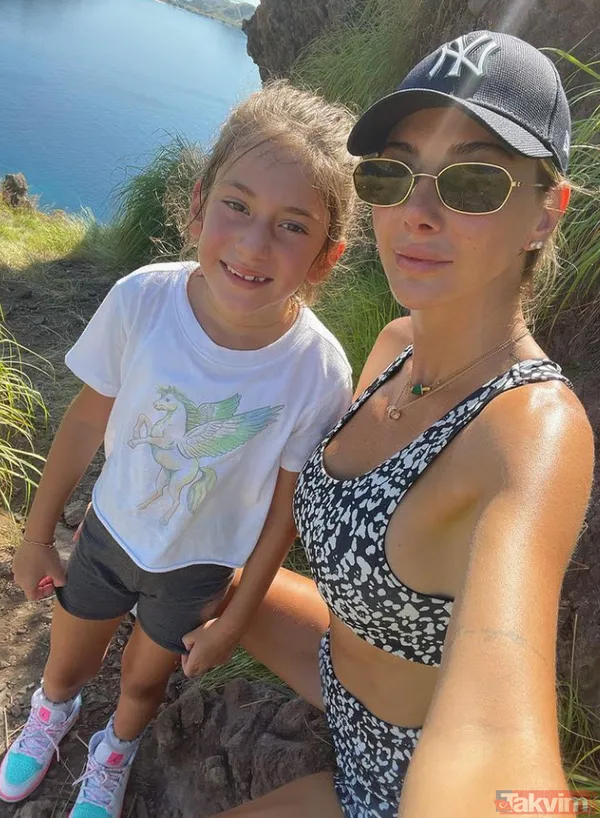 Acun Ilıcalı'nın yüzü gözü morluk içinde gören darp edildi sanıyor ama işin aslı başka! Estetik mi derken... - 20