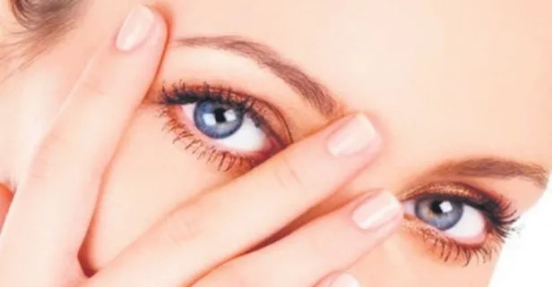 Uzman uyardı: Göz altı morlukları genetik olabileceği gibi yaşam tarzıyla da ilişkilidir